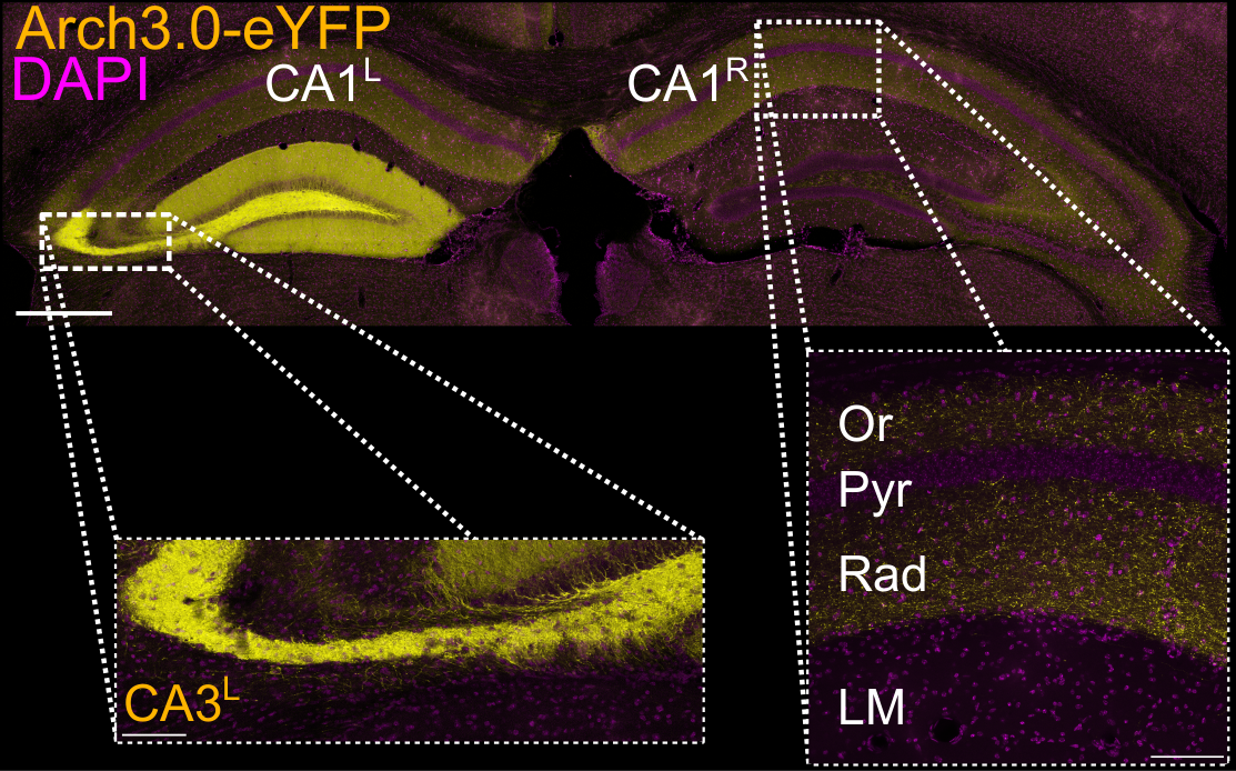 A confocal image showing axonal projections from the hippocampal CA3 to CA1 regions