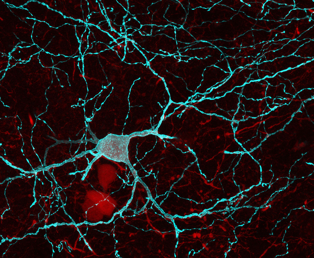 A picture of parvalbumin interneurons of the nucleus accumbens 