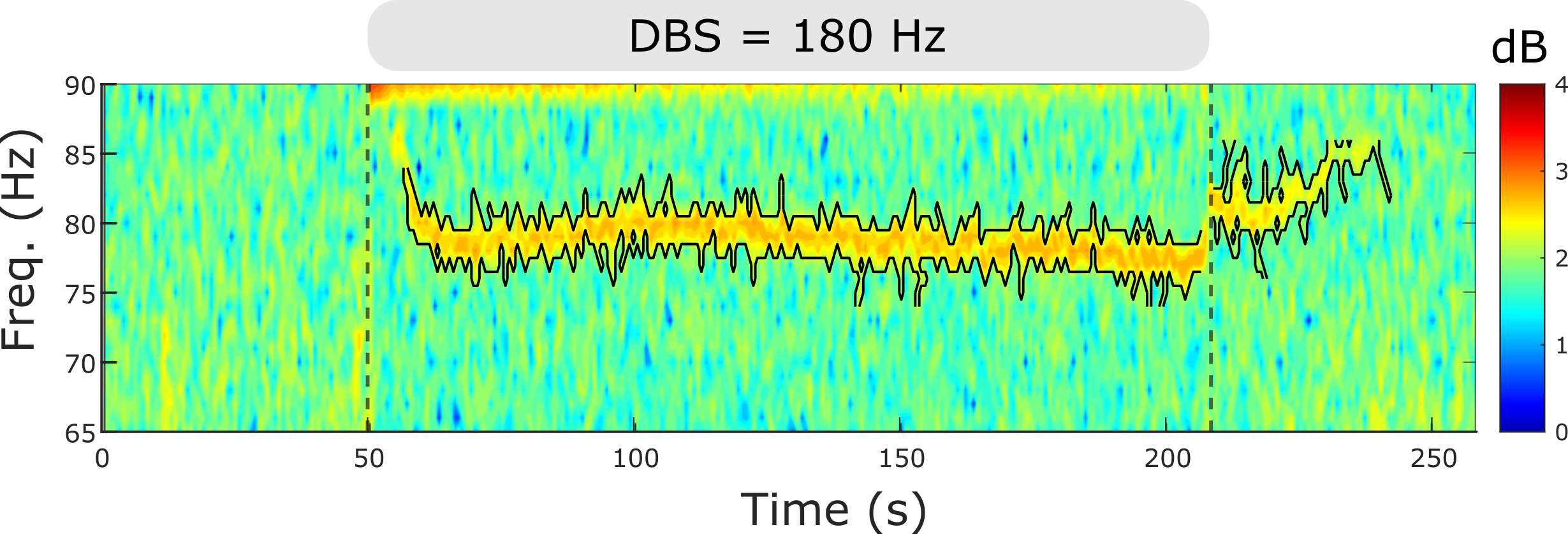 Spectrogram of nerve cell activity recorded in human brain.
