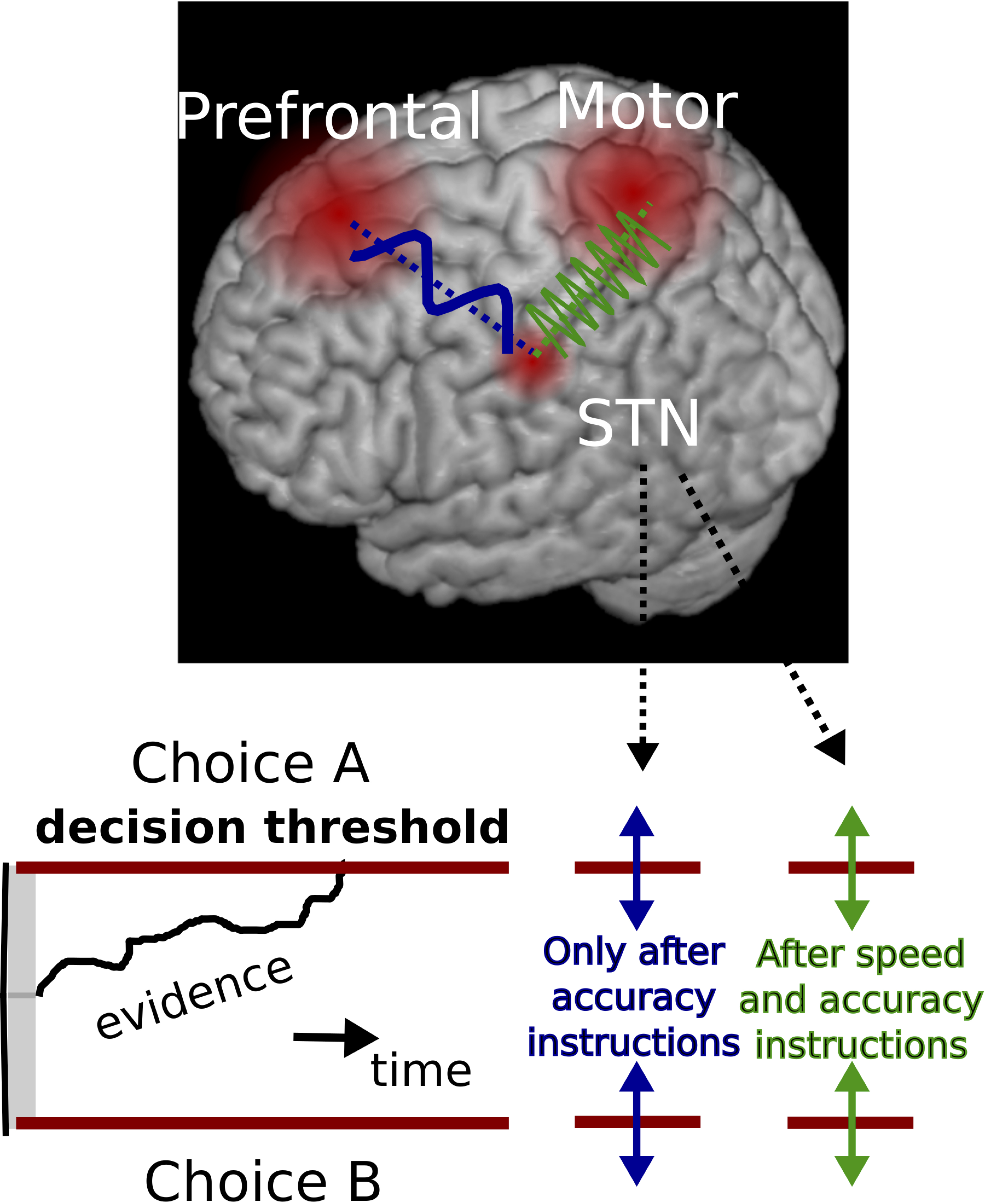 The subthalamic nucleus (STN) switches its interactions with two different cortical circuits (prefrontal cortex in blue, and motor cortex in green) to affect decision-making plans.