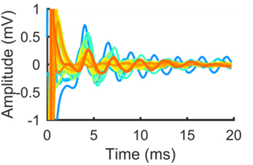 Evoked responses recorded from electrodes in 27 different subthalamic nuclei overlaid (colours represent different nuclei). Note the large and reproducible waveform that is evoked.
