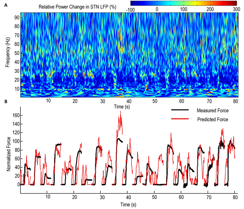 A person makes a series of manual grips with different efforts (black trace). We can predict changes in force from the neuronal activity (local field potentials) recorded at the same time in the subthalamic nucleus (red trace). Above these traces is the corresponding spectrogram of the local field potential.