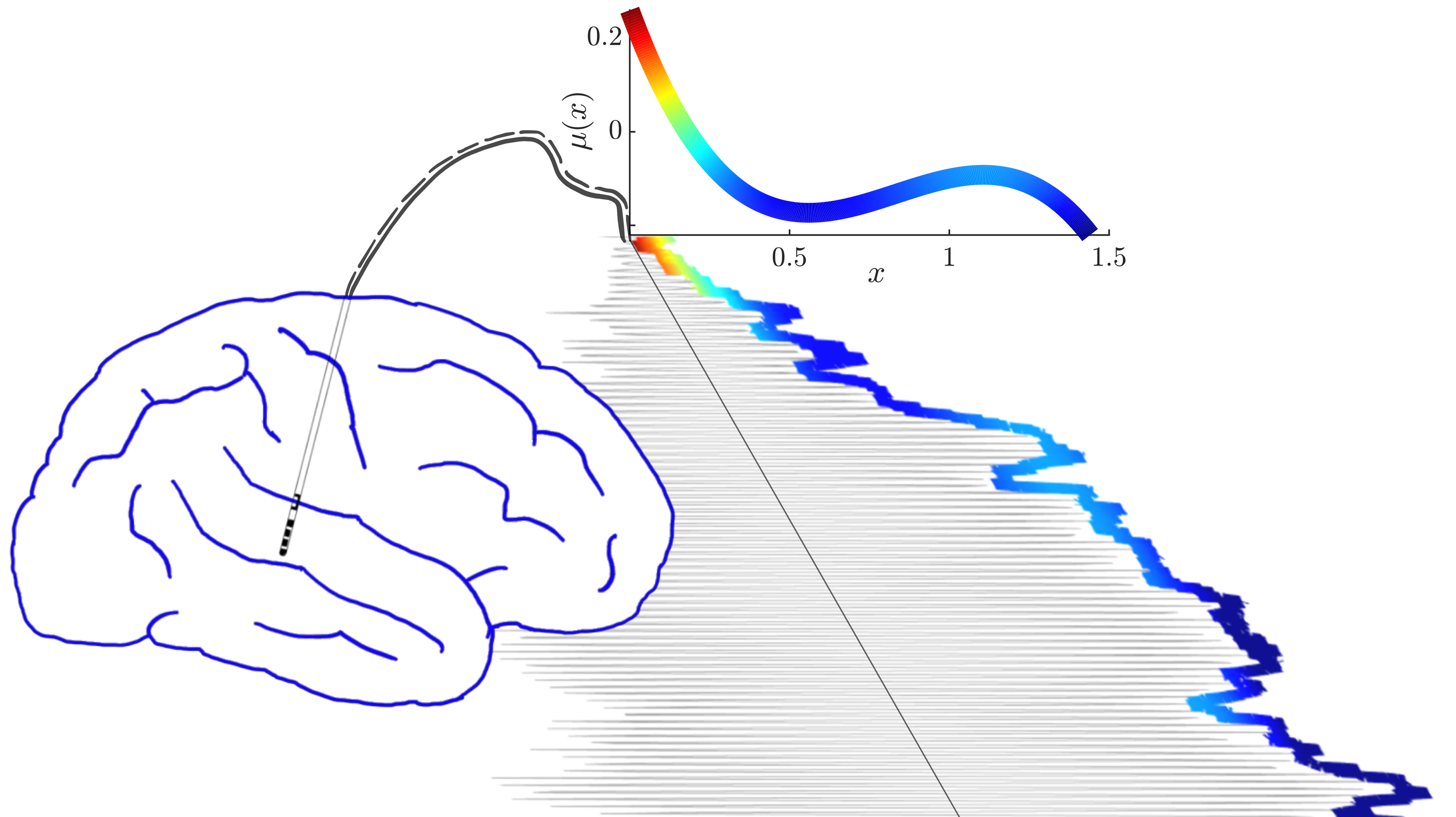 This figure shows a human brain with an implanted deep brain stimulation electrode and oscillatory activity recorded by the stimulation electrode. The figure highlights the relationship between the amplitude of the oscillatory activity and a curve which characterises the system generating the oscillatory activity and dictates which burst patterns can emerge. 