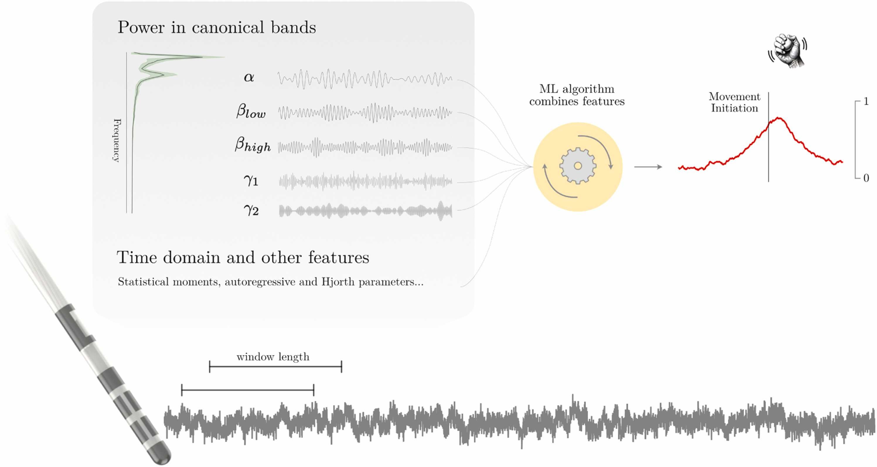 Feature-Extraction Pipeline for Real-Time Pre-Movement Decoding.
