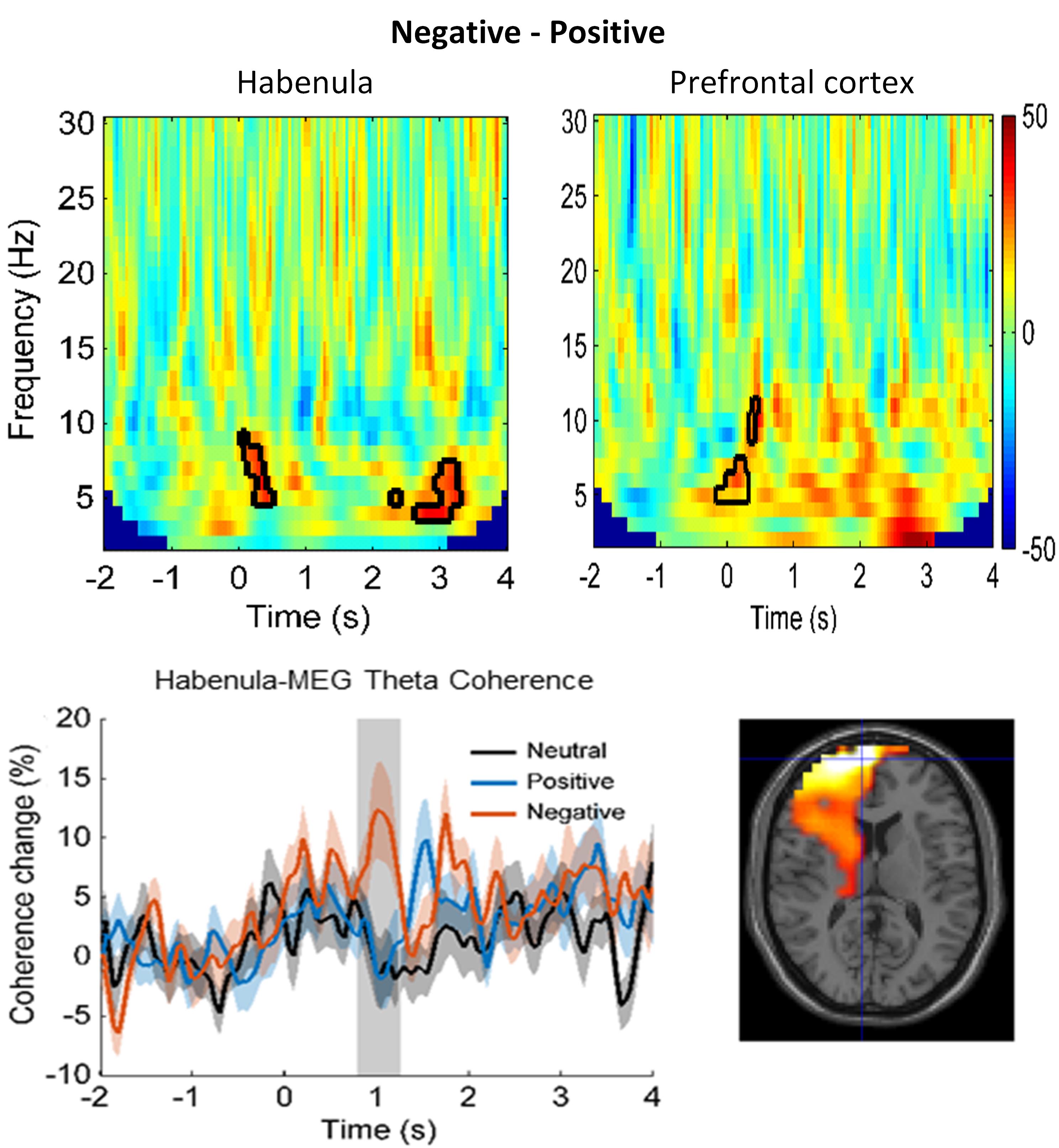 At the top, and lower left, are three coloured pictures of the frequency content of brain rhythms. On the lower right, there is brain scan to which colours have been added.