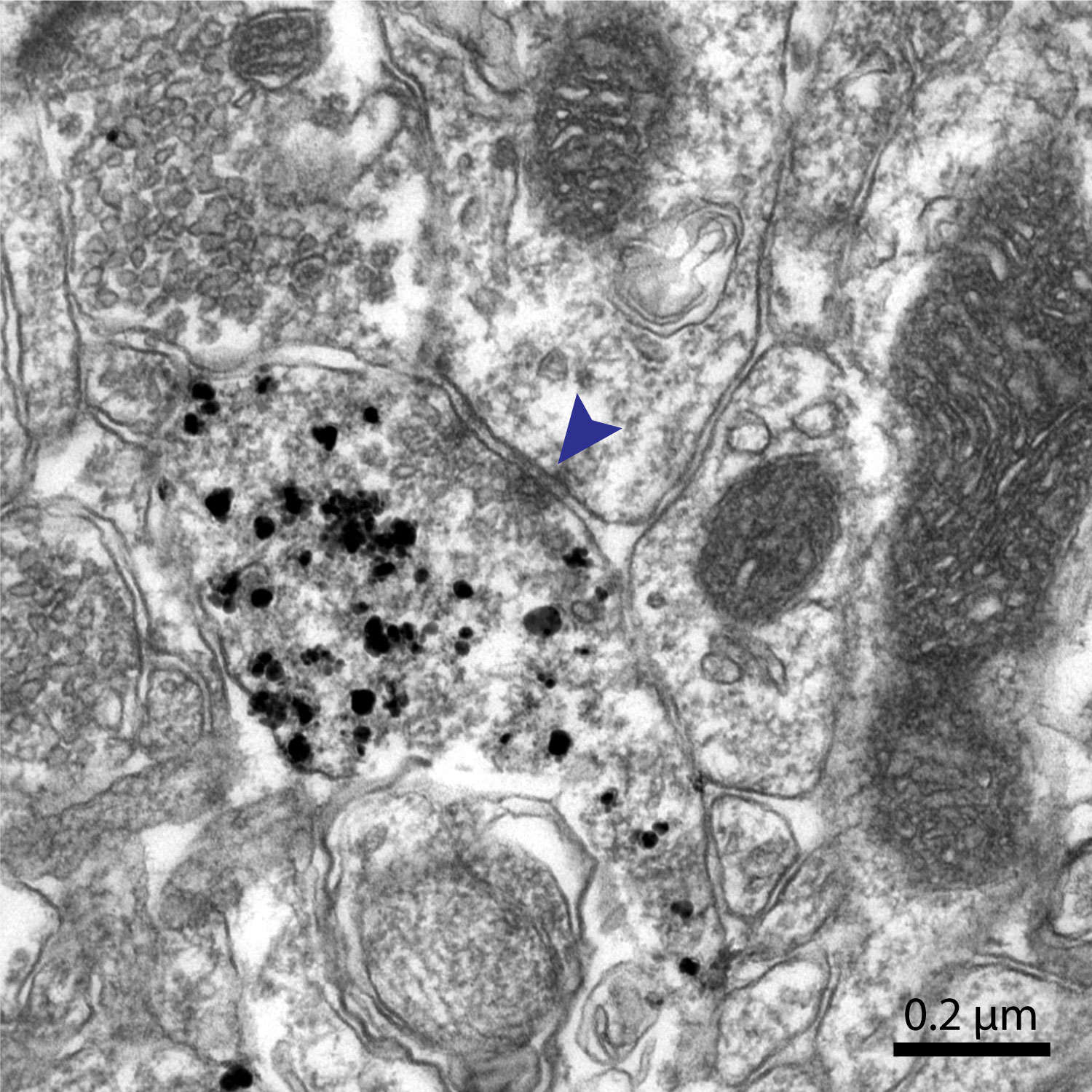 An image of the brain taken with an electron microscope.