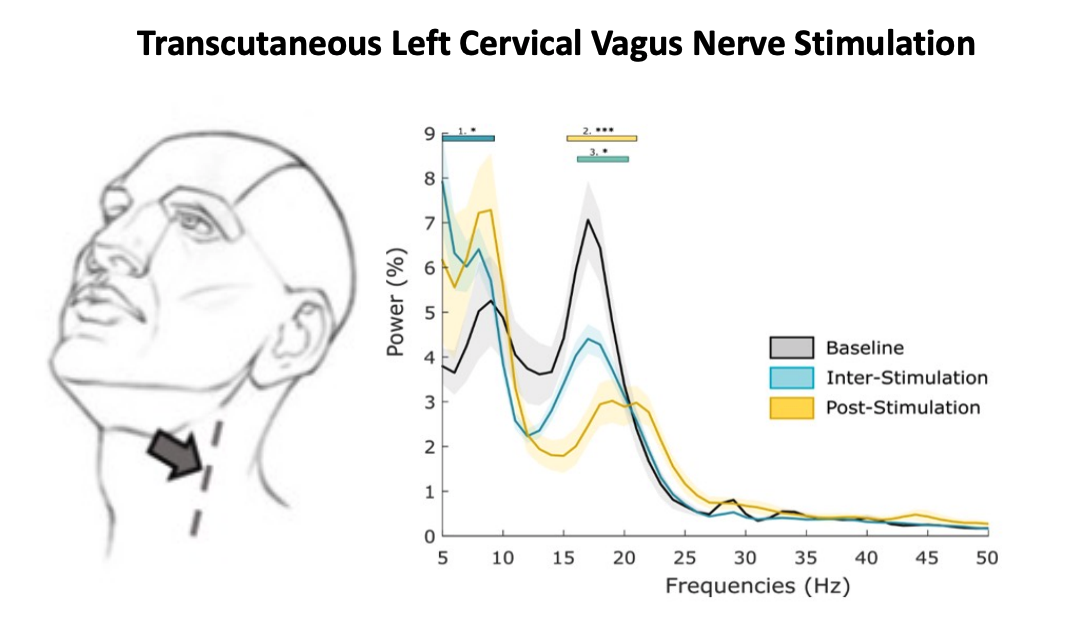 Figure made up of two panels. On the left, a human head with an arrow at the side of their neck pointing to the vagus nerve. On the right, a plot of power as a function of frequency in three conditions (baseline, inter-stimulation and post-stimulation)