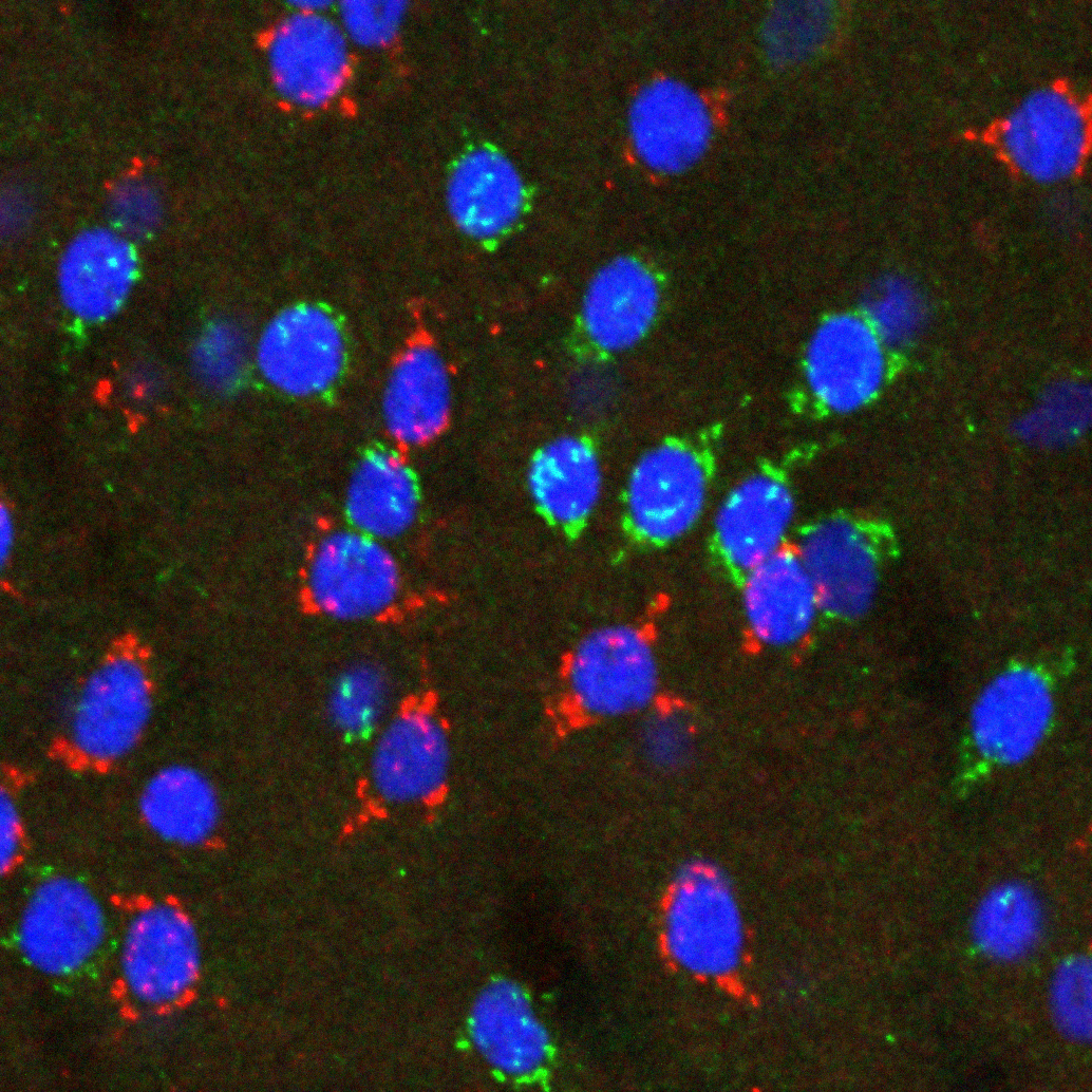 The dichotomy in striatum revealed: Two different types of spiny projection neuron.