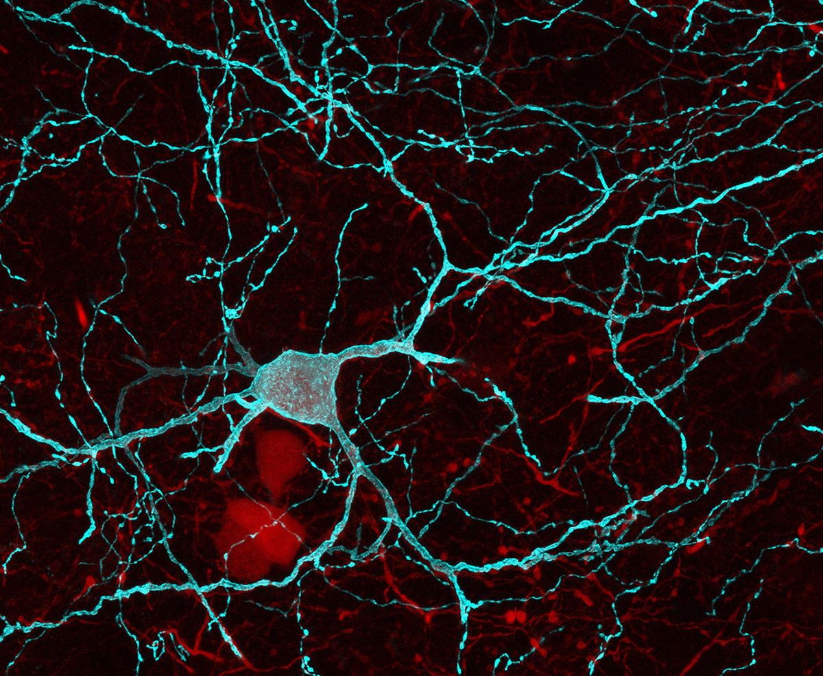 A picture of parvalbumin interneurons of the nucleus accumbens