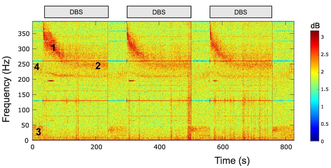 A coloured graph of electrical activity recorded in the human brain.