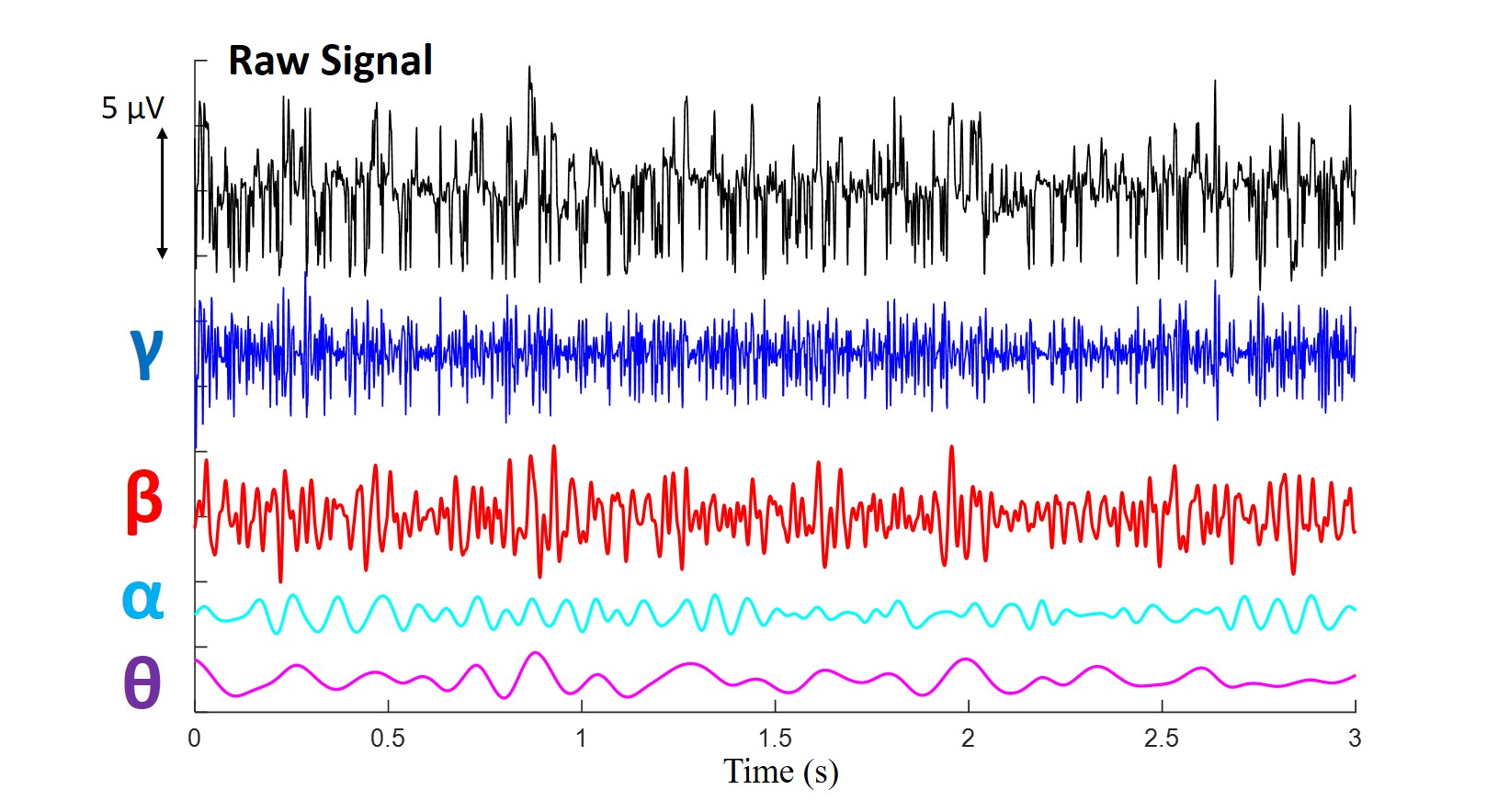 A picture of electrical (activity) recroded in the human brain