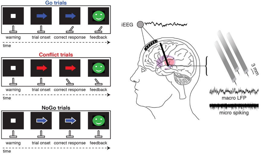 Left: The arrow task performed by the subjects. Right: The electrical signals recorded from the deep brain (subthalamic nucleus) and superficial brain (medial prefrontal cortex) during task execution.