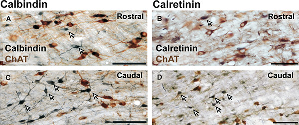 Subpopulations of cholinergic, GABAergic and glutamatergic neurons in the pedunculopontine nucleus contain calcium-binding proteins and are heterogeneously distributed.