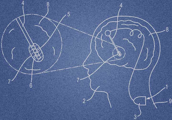 fig 1 from the pattern application: in the style of a blueprint, a diagram of the head and brain with an electrode