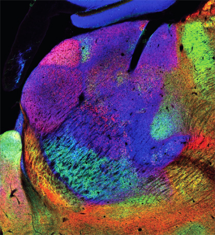 
A parasagittal section (lateral ~1.5 mm) of the rat thalamus fluorescently labeled with immunoreactivities for GAD67 (green),VGluT2 (red), and VGluT1 (blue) shows GAD67-rich basal ganglia-recipient zone and VGluT2-abundant cerebellar recipient zone of the motor thalamus. See Nakamura et al. 2014. Temporal coupling with cortex distinguishes spontaneous neuronal activities in identified basal ganglia-recipient and cerebellar-recipient zones of motor thalamus.