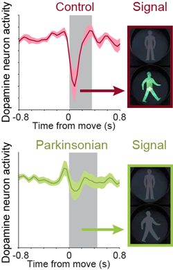A pause in the electrical activity of dopamine nerve cells in control mice signals the onset of movement. This signal is lost in Parkinsonian mice.