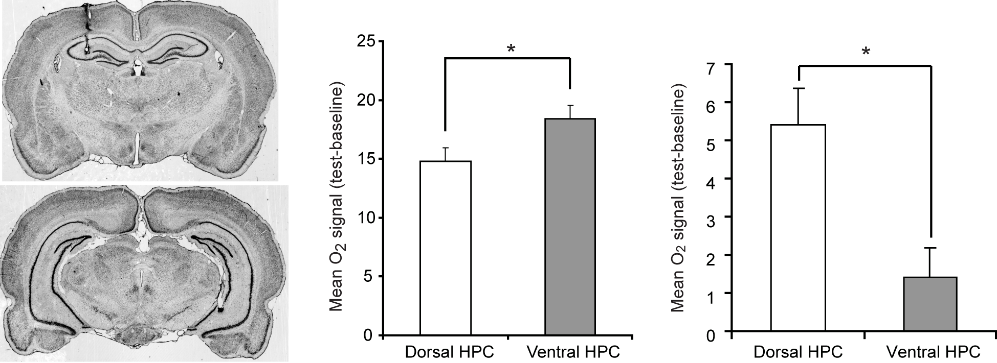 Electrodes to record hemodynamic responses were inserted into the dorsal and ventral hippocampus in rats (left panel). During anxiety tasks, greater activation was found in the ventral than dorsal hippocampus (middle panel). During a spatial memory task, greater activation was found in dorsal than ventral hippocampus (right panel).