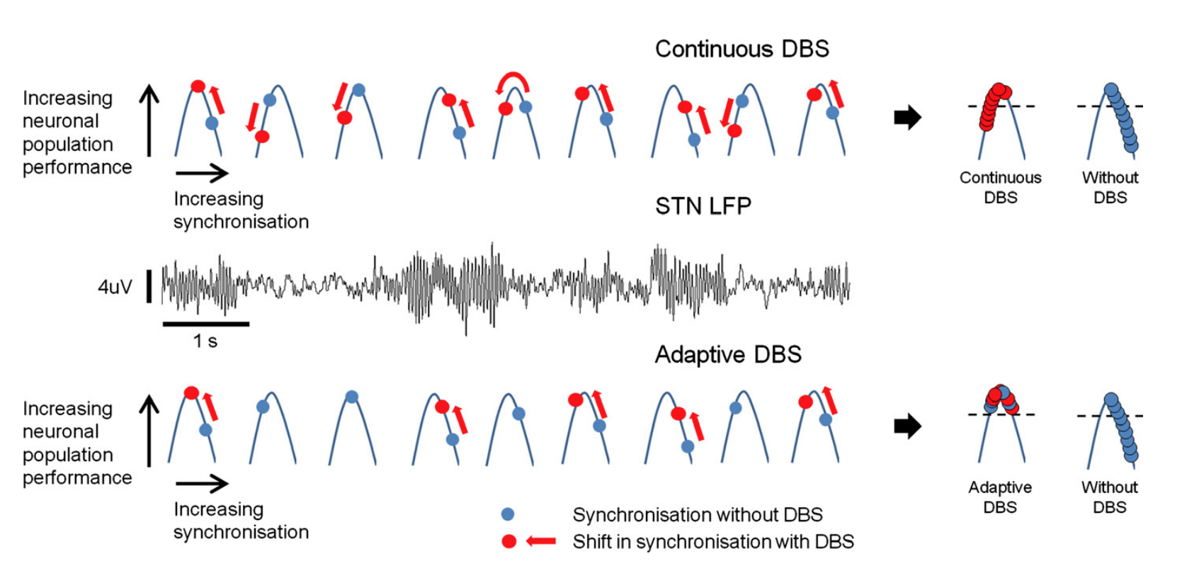 The highs and lows of beta activity in cortico-basal ganglia loops.
