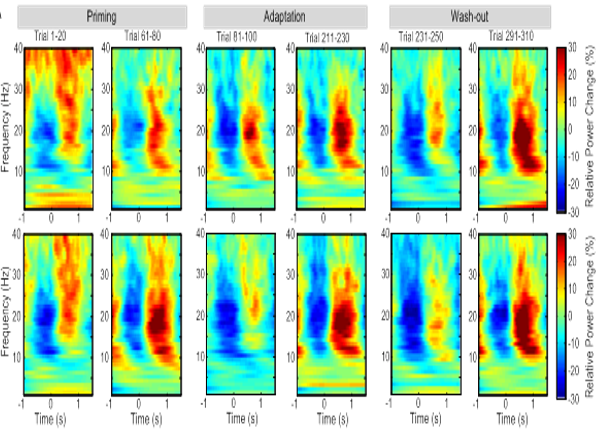 Post-Movement Beta Activity in Sensorimotor Cortex Indexes Confidence in the Estimations from Internal Models.