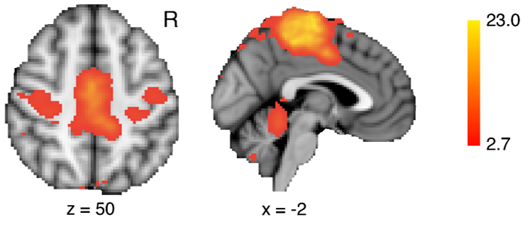 Motor “resting state networks” seen with fMRI.