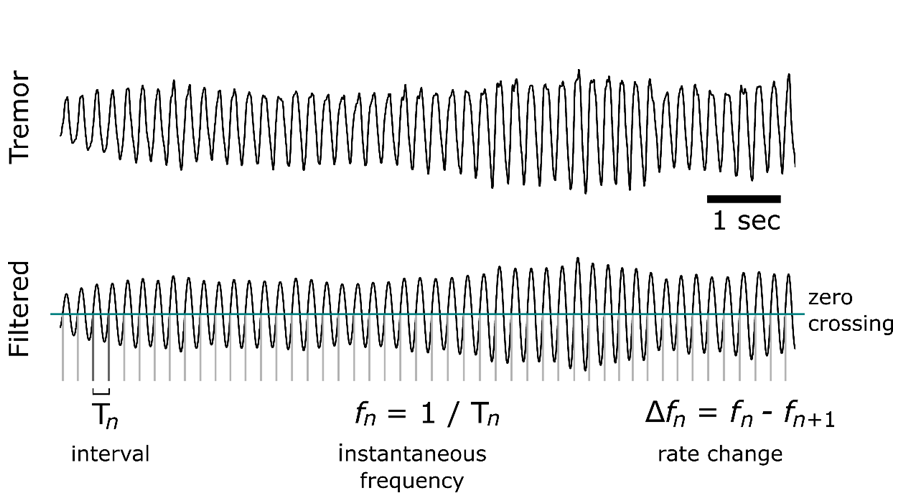 Illustration of the procedure used to extract the instantaneous frequency as well as the variation in the frequency of the tremor.