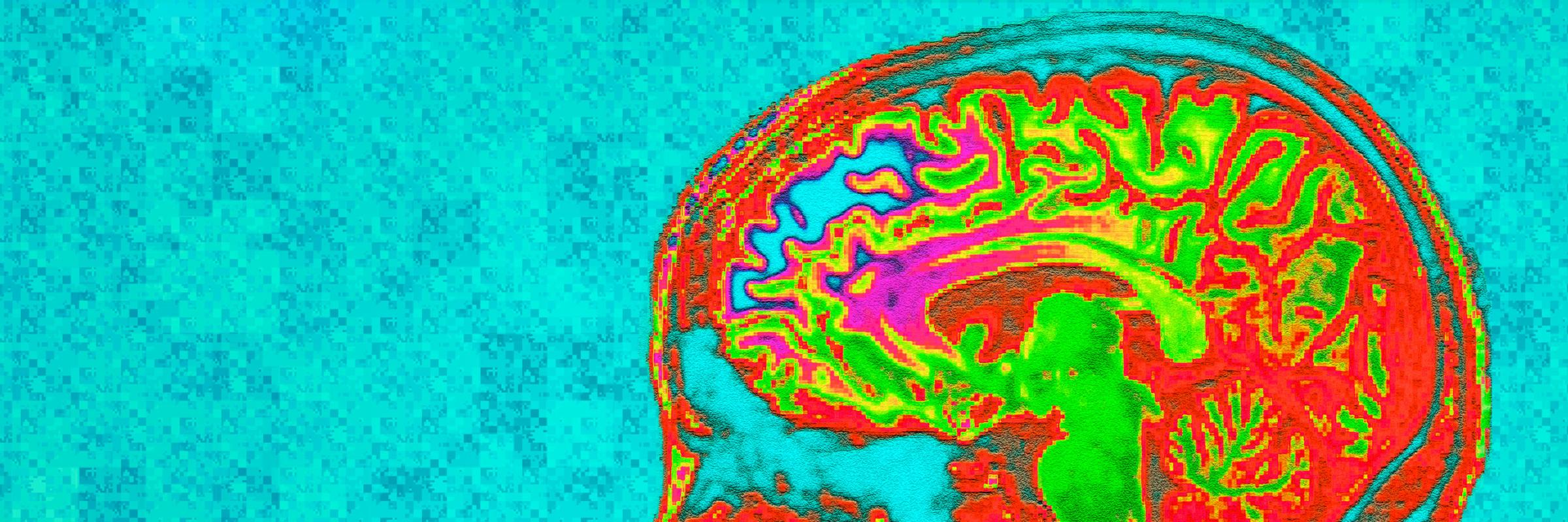 Stagg Group | mrcbndu