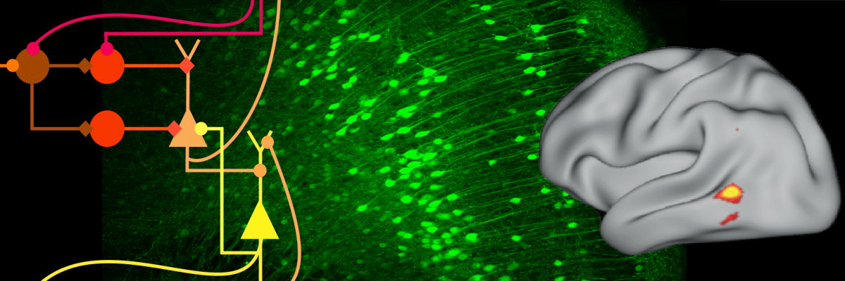 diagram of neural circuits, a fluorescence micrograph of cells in the hippocampus, an activity map plotted into a brain surface