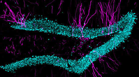 Microscope images of mouse dentate gyrus containing neurons coloured in pink and cyan.