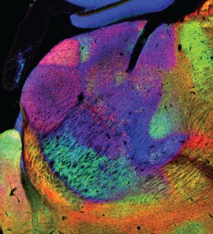 Image of a rat brain, pseudocoloured to highlight different parts of the thalamus