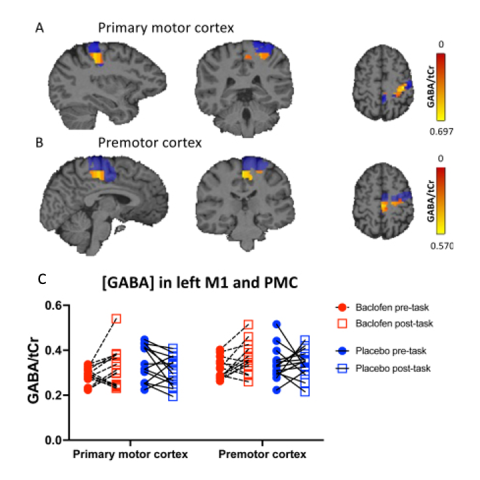 Three rows. Top two are grey-scale brain sections with blue and red maps overlapped on them. Bottom row is a figure of red and blue circles and squares showing changes in GABA during motor learning