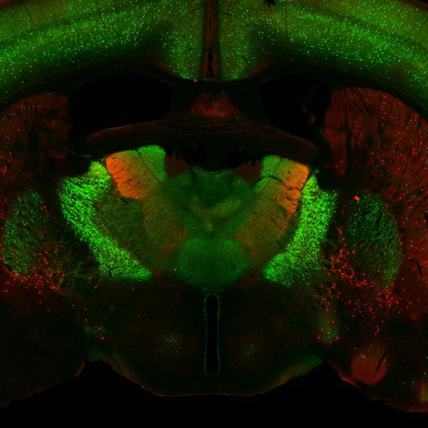 red and green immunofluorescence image of mouse brain section