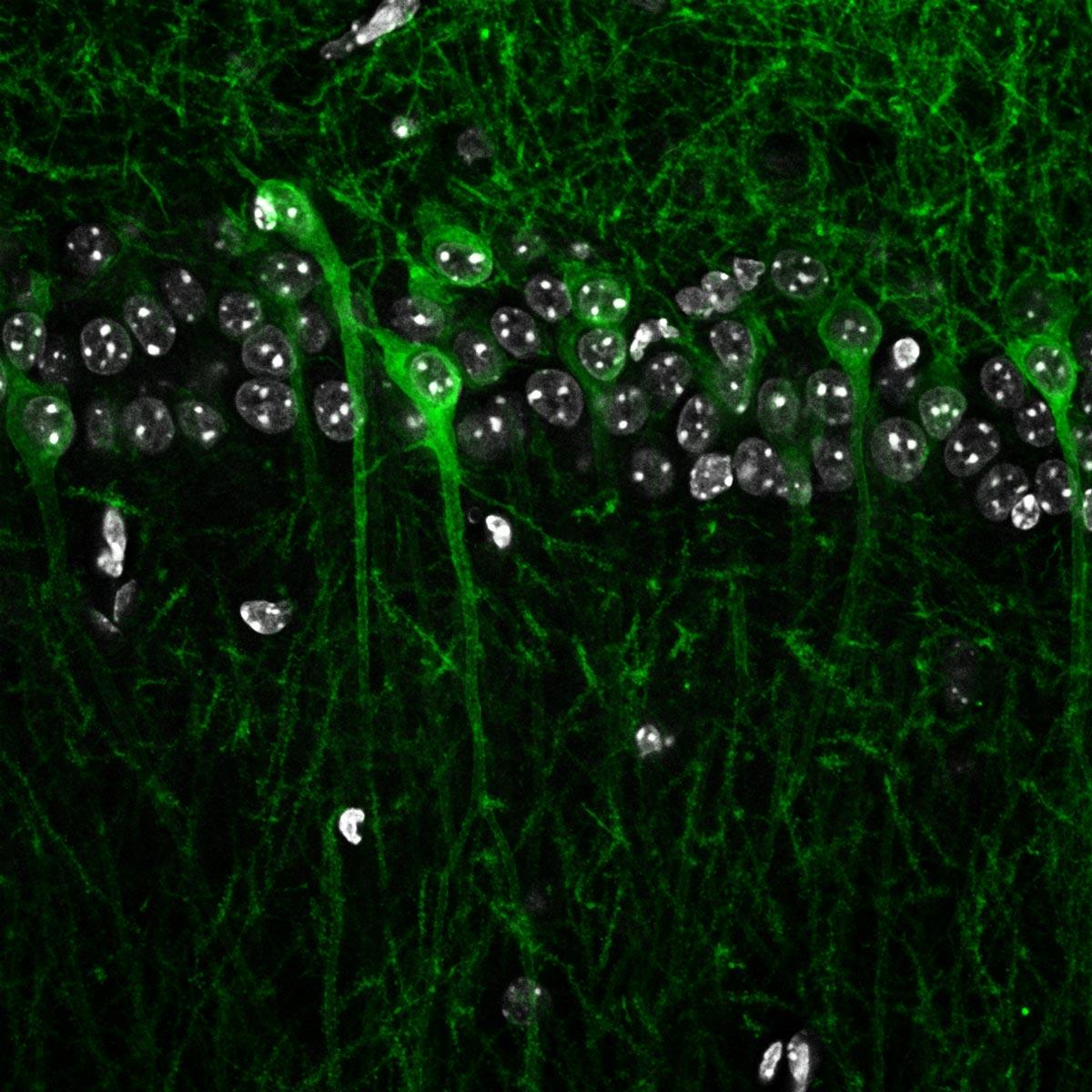 Confocal micrograph of green cells amongst unlabelled cells with white nuclei.