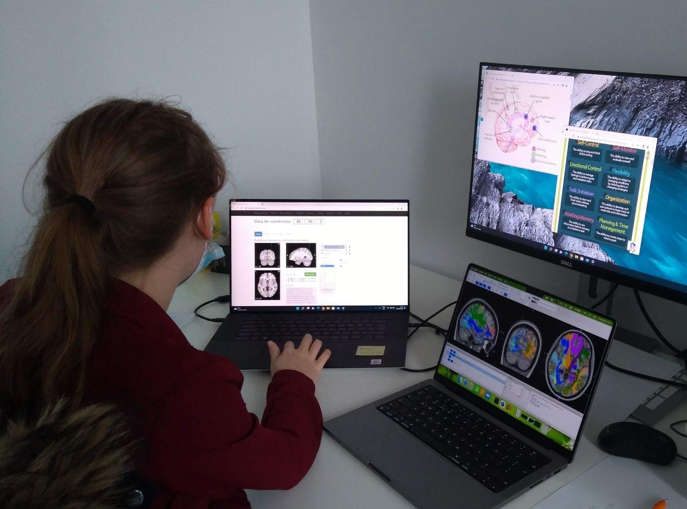 Photo of a visiting In2scienceUK school pupil looking at images of the brain.