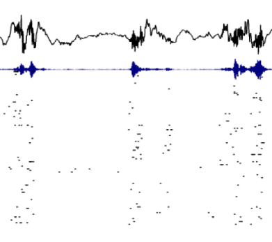 A picture of electrophysiological data recorded from mouse hippocampus.