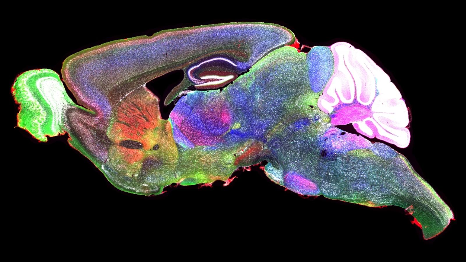 Image of mosue brain section